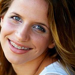 Zahnspangen für Kinder & Erwachsene in München Zahnspangen in München