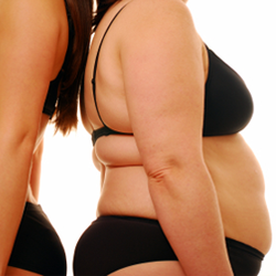 Fettabsaugung in Essen Fettabsaugung in Essen